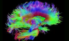 brain simulation